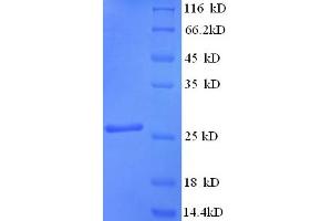 SDS-PAGE (SDS) image for Synaptosomal-Associated Protein, 25kDa (SNAP25) (AA 1-206), (full length) protein (His tag) (ABIN5710384)