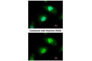 Immunofluorescence (IF) image for anti-Casein Kinase 2, beta (CSNK2B) antibody (ABIN2855043)
