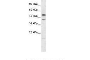 Image no. 2 for anti-POU Class 3 Homeobox 1 (POU3F1) (N-Term) antibody (ABIN202549) (POU3F1 antibody  (N-Term))