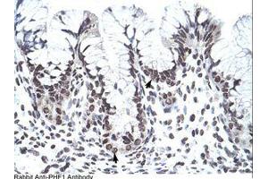 Image no. 1 for anti-PHD Finger Protein 1 (PHF1) (AA 421-470) antibody (ABIN202770) (PHF1 antibody  (AA 421-470))