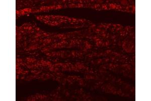 IF analysis of SF3A1 using anti-SF3A1 antibody (ABIN7600556). (SF3A1 antibody  (AA 20-556))