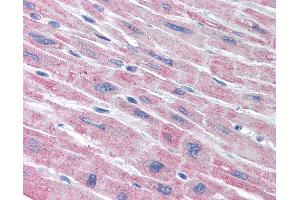 Anti-PLA2G5 antibody IHC of human heart. (PLA2G5 antibody)