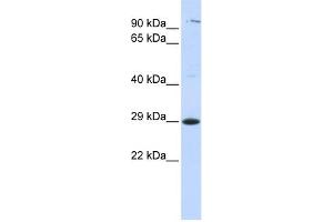WB Suggested Anti-TSPAN2 Antibody Titration:  0. (Tetraspanin 2 antibody  (Middle Region))