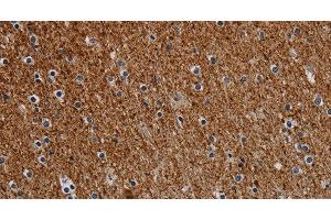 Immunohistochemistry of paraffin-embedded Human brain tissue using DCAF6 Polyclonal Antibody at dilution 1:30 (DCAF6 antibody)