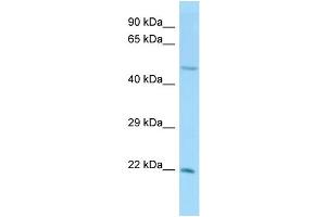 Host:  Rabbit  Target Name:  Ube2h  Sample Type:  Mouse Testis lysates  Antibody Dilution:  1. (UBE2H antibody  (N-Term))