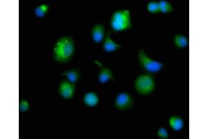 Immunofluorescence staining of MCF-7 cells with ABIN7164840 at 1:166, counter-stained with DAPI. (Prosaposin antibody  (AA 311-391))