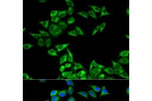 Immunofluorescence analysis of MCF-7 cells using CHMP2B Polyclonal Antibody (CHMP2B antibody)
