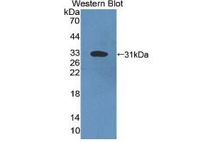 Western blot analysis of the recombinant protein. (Complement C4 antibody  (AA 126-366))