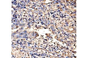 IHC analysis of HECTD1 using anti-HECTD1 antibody (ABIN7601584). (HECTD1 antibody  (AA 39-566))
