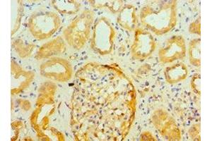 Immunohistochemistry of paraffin-embedded human kidney tissue using ABIN7143947 at dilution of 1:100 (SNCA antibody  (AA 61-140))