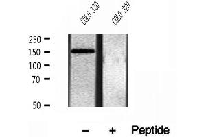 CEMIP antibody  (C-Term)