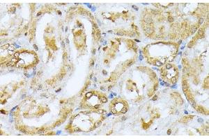 Immunohistochemistry of paraffin-embedded Rat kidney using RPS27A Polyclonal Antibody at dilution of 1:100 (40x lens). (RPS27A antibody)