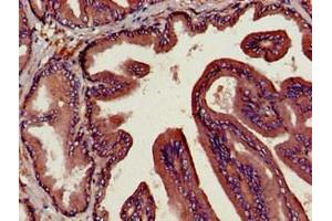 Immunohistochemistry of paraffin-embedded human prostate tissue using ABIN6953148 at dilution of 1:100 (DPP4 antibody  (AA 473-588))