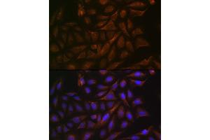 Immunofluorescence analysis of U-2 OS cells using V/V/Cellubrevin Rabbit mAb (ABIN7271314) at dilution of 1:100 (40x lens). (VAMP3 antibody)