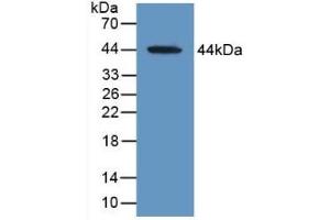 Detection of Recombinant MAG, Human using Polyclonal Antibody to Myelin Associated Glycoprotein (MAG) (MAG antibody  (AA 133-237))