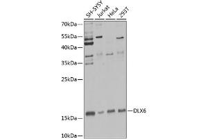 Western blot analysis of extracts of various cell lines, using DLX6 Antibody (ABIN6131792, ABIN6139675, ABIN6139676 and ABIN6223589) at 1:1000 dilution. (DLX6 antibody  (AA 119-293))
