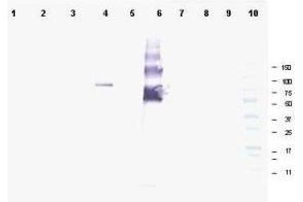 ANKRD26 anticorps  (AA 1-15)