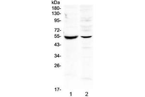 Western blot testing of 1) mouse intestine and 2) human SMMC-7721 lysate with MMP16 antibody at 0. (MMP16 antibody)