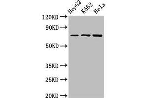 Western Blot Positive WB detected in: HepG2 whole cell lysate, K562 whole cell lysate, Hela whole cell lysate All lanes: DBF4 antibody at 2.