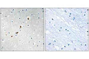 Immunohistochemistry analysis of paraffin-embedded human brain tissue using ZNF596 antibody.