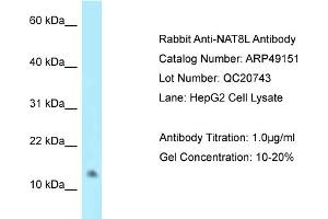 WB Suggested Anti-NAT8L Antibody   Titration: 1. (NAT8L antibody  (C-Term))