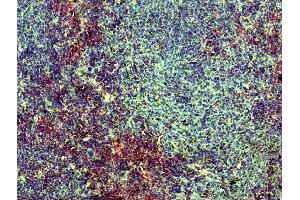 Immunohistochemistry (IHC) image for Goat anti-Mouse Immunoglobulin kappa Chain Complex (Igk) antibody (ABIN376862)