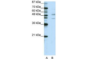 WB Suggested Anti-SMAD2 Antibody Titration:  2. (SMAD2 antibody  (N-Term))