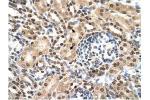 IFIT3 antibody was used for immunohistochemistry at a concentration of 4-8 ug/ml to stain EpitheliaI cells of renal tubule (arrows) in Human Kidney. (IFIT3 antibody  (N-Term))