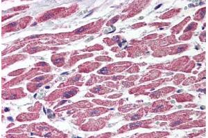 Human Heart (formalin-fixed, paraffin-embedded) stained with TSC1 antibody ABIN214539 at 2. (TSC1 antibody)