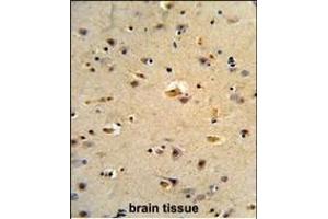 Immunohistochemistry (Paraffin-embedded Sections) (IHC (p)) image for anti-CDK5 Regulatory Subunit Associated Protein 1 (CDK5RAP1) (AA 544-571), (C-Term) antibody (ABIN652977)