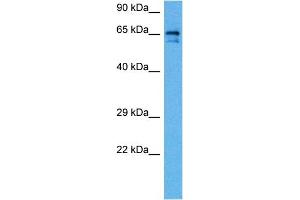 Host:  Rabbit  Target Name:  SLC6A2  Sample Tissue:  Rat Brain  Antibody Dilution:  1ug/ml (SLC6A2 antibody  (Middle Region))