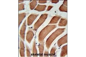 SIKE Antibody (C-term) (ABIN651568 and ABIN2840305) immunohistochemistry analysis in formalin fixed and paraffin embedded human skeletal muscle followed by peroxidase conjugation of the secondary antibody and DAB staining. (SIKE1 antibody  (C-Term))