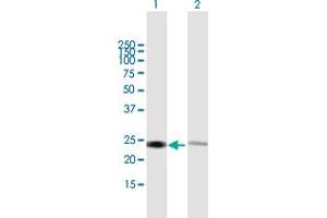 Western Blot analysis of RPL14 expression in transfected 293T cell line by RPL14 MaxPab polyclonal antibody. (RPL14 antibody  (AA 1-220))