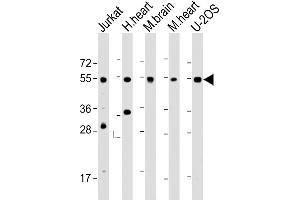 All lanes : Anti-IRX4 Antibody (C-Term) at 1:2000 dilution Lane 1: Jurkat whole cell lysate Lane 2: human heart lysate Lane 3: mouse brain lysate Lane 4: mouse heart lysate Lane 5: U-2OS whole cell lysate Lysates/proteins at 20 μg per lane. (IRX4 antibody  (AA 107-141))