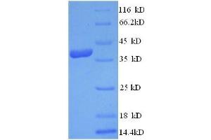 C-Fos Induced Growth Factor (Vascular Endothelial Growth Factor D) (Figf) (AA 89-205), (full length) protein (GST tag) (VEGFD Protein (AA 89-205, full length) (GST tag))