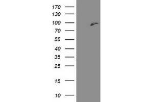 HEK293T cells were transfected with the pCMV6-ENTRY control (Left lane) or pCMV6-ENTRY DPP3 (Right lane) cDNA for 48 hrs and lysed. (DPP3 antibody)