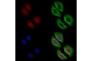 ABIN6262216 and ABIN6269364 staining Hela cells by IF/ICC.