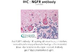 Image no. 1 for anti-Nerve Growth Factor Receptor (NGFR) antibody (ABIN1737340) (NGFR antibody)