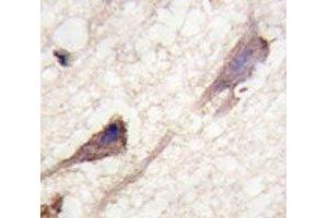IHC analysis of FFPE human brain tissue stained with BRAF antibody (BRAF antibody  (AA 580-609))