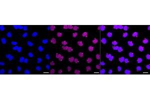 Immunocytochemical staining of Hela cells with GATAD2A antibody (ABIN7798698), 1:1,000).