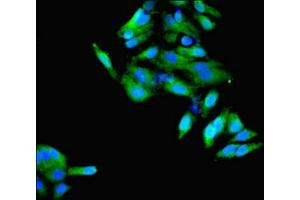 Immunofluorescent analysis of Hela cells using ABIN7148610 at dilution of 1:100 and Alexa Fluor 488-congugated AffiniPure Goat Anti-Rabbit IgG(H+L) (HSD11B1 antibody  (AA 25-292))