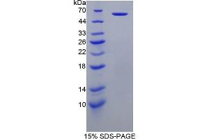 SDS-PAGE (SDS) image for Perforin 1 (Pore Forming Protein) (PRF1) (AA 32-316) protein (His tag,GST tag) (ABIN2123448)