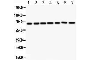 Western Blotting (WB) image for anti-Angiopoietin 1 (ANGPT1) (AA 16-350) antibody (ABIN3043724) (Angiopoietin 1 antibody  (AA 16-350))