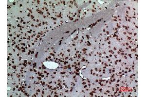 Immunohistochemistry (IHC) analysis of paraffin-embedded Rat Brain, antibody was diluted at 1:100. (Midkine antibody  (Internal Region))