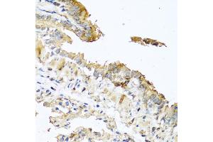 Immunohistochemistry of paraffin-embedded mouse lung using RNASE11 antibody (ABIN5970447) at dilution of 1/100 (40x lens). (RNASE11 antibody)