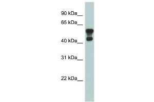 PAFAH1B1 antibody used at 1 ug/ml to detect target protein. (PAFAH1B1 antibody  (N-Term))