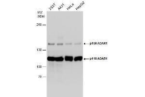 WB Image Various whole cell extracts (30 μg) were separated by 5% SDS-PAGE, and the membrane was blotted with ADAR1 antibody [N3C1], Internal , diluted at 1:1000. (ADAR antibody)