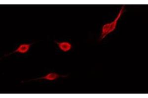 ABIN6275503 staining COLO205 cells by IF/ICC. (RHOD antibody  (Internal Region))