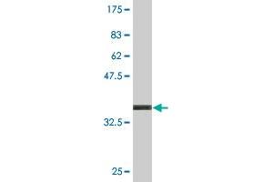 Western Blot detection against Immunogen (36. (Kelch-Like 4 antibody  (AA 1-100))