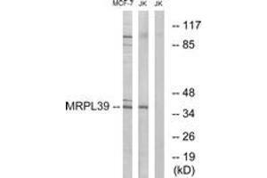 Western blot analysis of extracts from Jurkat/MCF-7 cells, using MRPL39 Antibody. (MRPL39 antibody  (AA 289-338))